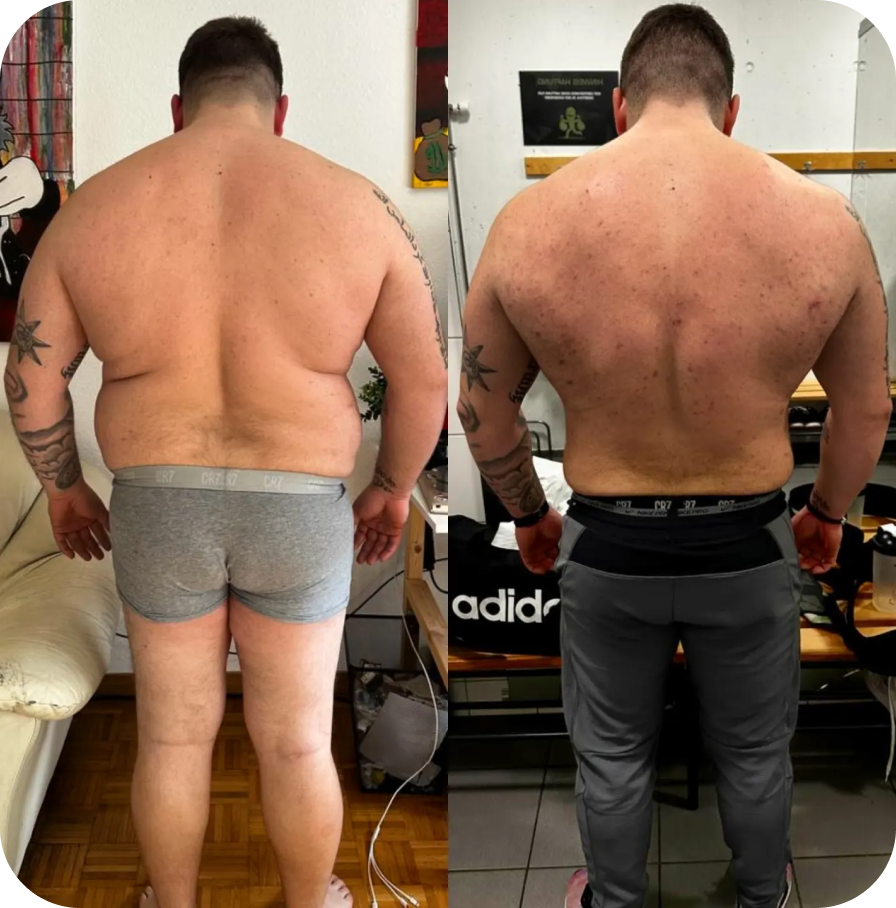 Transformation gallery 2